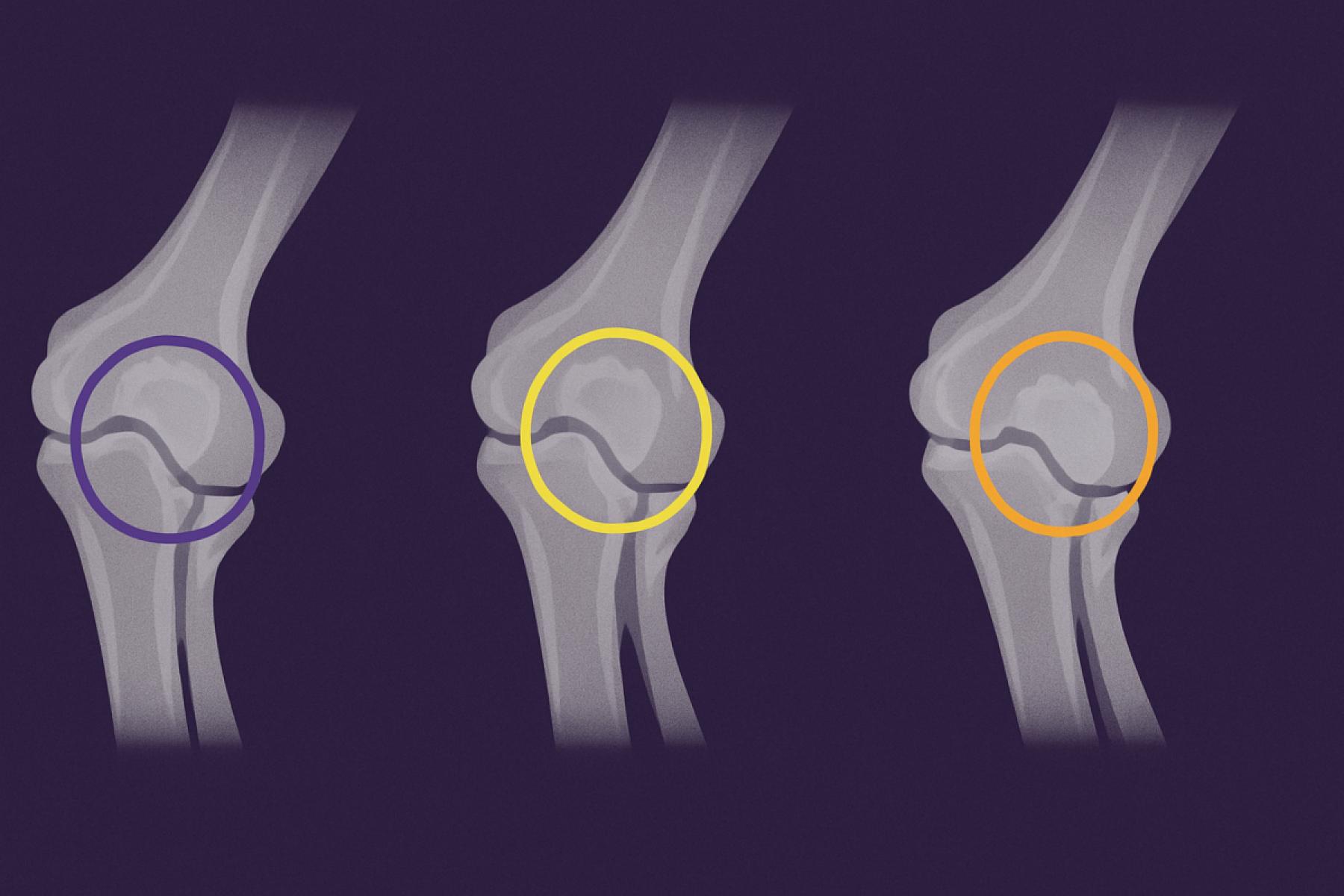 ANKC Hip and Elbow Scoring System